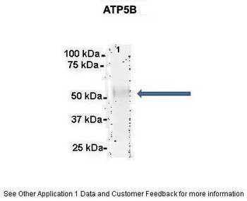 ATP5B Antibody