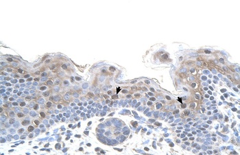 STRAP Antibody