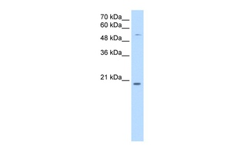 CHIC2 Antibody