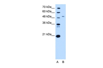 SPTLC1 Antibody