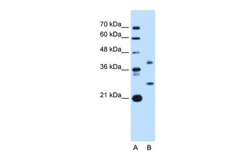 ST8SIA2 Antibody