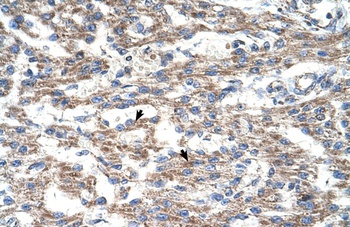 DUT Antibody