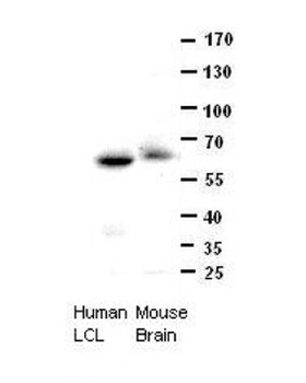 CCT8 Antibody