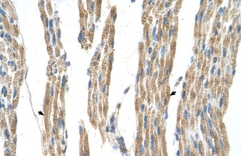 GPT Antibody