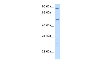 GPT Antibody