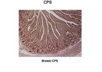 CPS1 Antibody