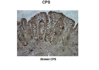 CPS1 Antibody