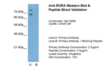 RORA Antibody