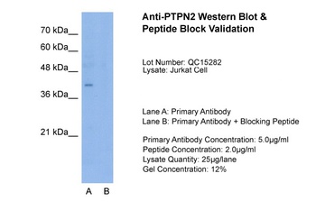 PTPN2 Antibody