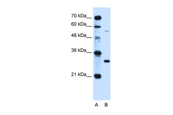 HFE Antibody