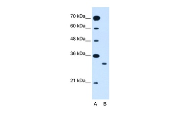 SLC25A22 Antibody