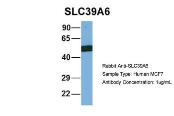 SLC39A6 Antibody