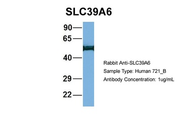 SLC39A6 Antibody