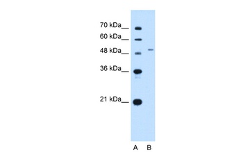 SLC29A2 Antibody