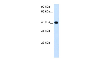 ADH4 Antibody