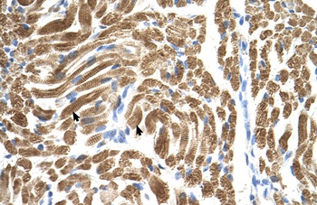 PEX10 Antibody