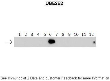 UBE2E2 Antibody