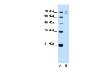 RNF168 Antibody