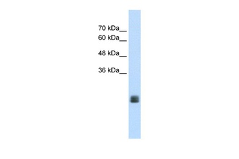 TMEM178A Antibody