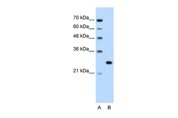 FOXR2 Antibody