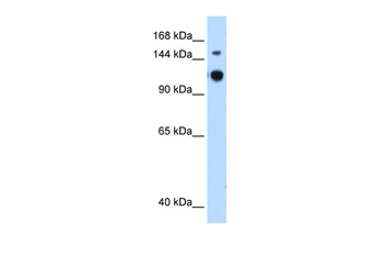 GAPVD1 Antibody