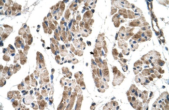 ITGB1BP2 Antibody