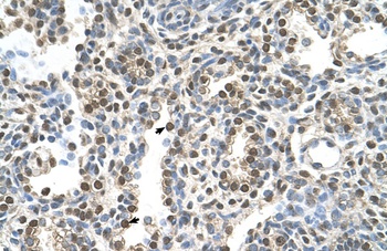 MAGEA8 Antibody