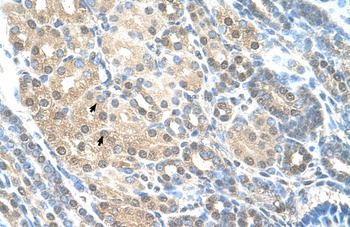 RAD23A Antibody