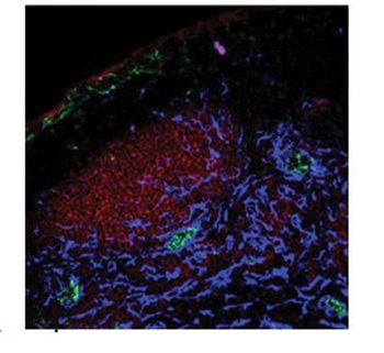 PPAP2A Antibody