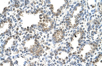 TST Antibody