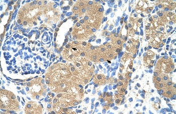 TNNI1 Antibody