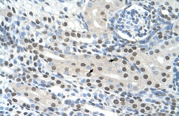 SEMG1 Antibody