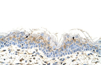 S100A3 Antibody