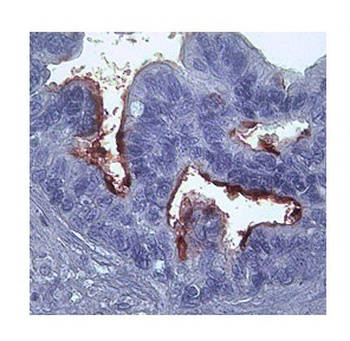 MMP1 Antibody