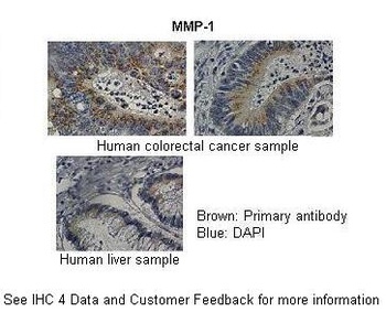 MMP1 Antibody