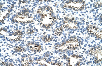 KRT13 Antibody
