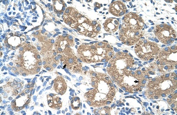 ALAS2 Antibody