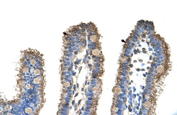 RHOBTB1 Antibody