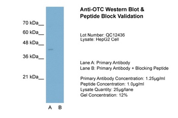 OTC Antibody