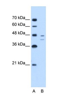 FAH Antibody