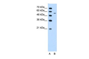 CHST7 Antibody