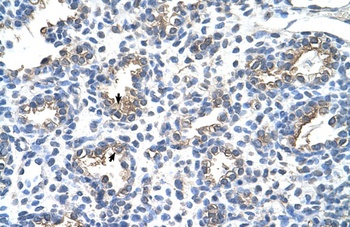 CEACAM6 Antibody