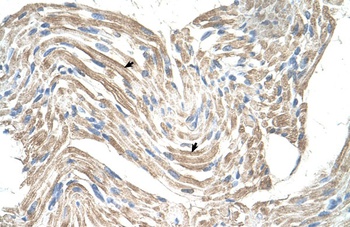 CKMT2 Antibody