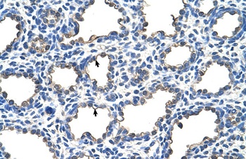 EMP2 Antibody