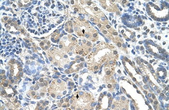 PRPS2 Antibody