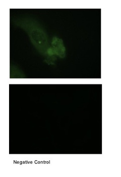 MUC1 Antibody