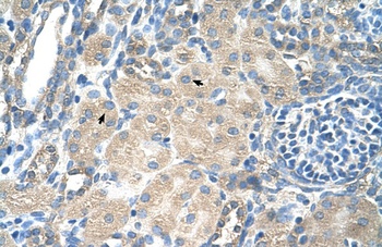 SLC13A3 Antibody