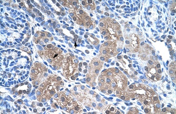 FBP1 Antibody