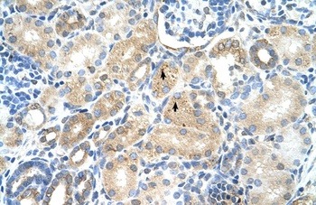 MAT1A Antibody