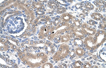 SLC12A1 Antibody